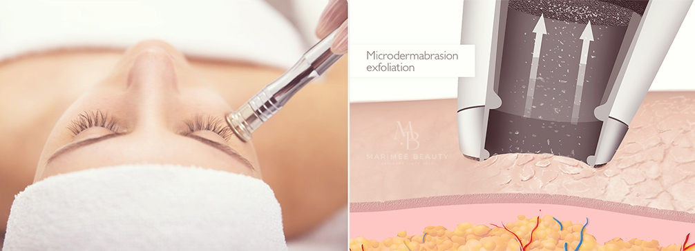 Teemantlihvimine ehk DMD-marimee beauty.jpg (225 KB)